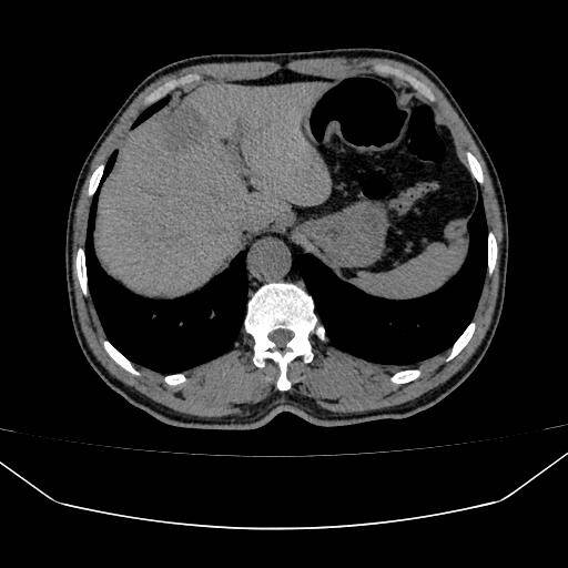 千汇网 济南市莱芜区新服务上线：上腹增强CT，守护居民健康